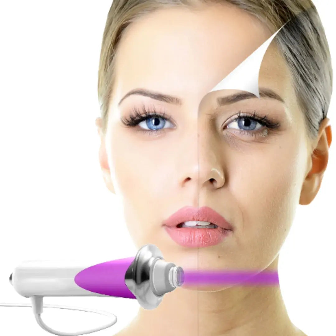 Beauty Stick Pro – Dispositivo Antienvelhecimento de Microcorriente