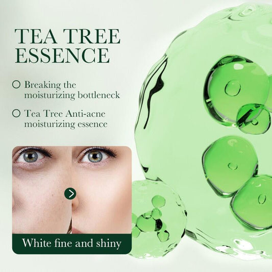 Creme Facial Controle da Acné com Aceite de Árbol de Té 50ml SADOER – Purifica, Calma e Regula o Exceso de Grasa