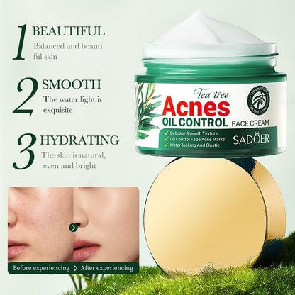 Creme Facial Controle da Acné com Aceite de Árbol de Té 50ml SADOER – Purifica, Calma e Regula o Exceso de Grasa